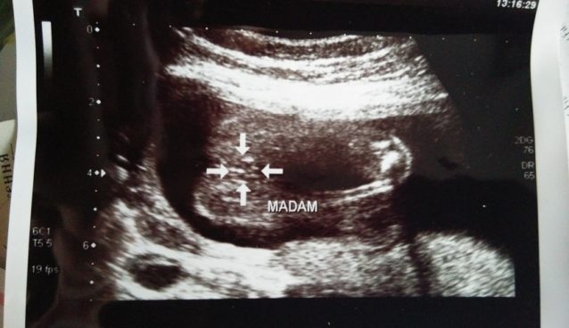 Should’ve stayed, were there signs, I ignored?